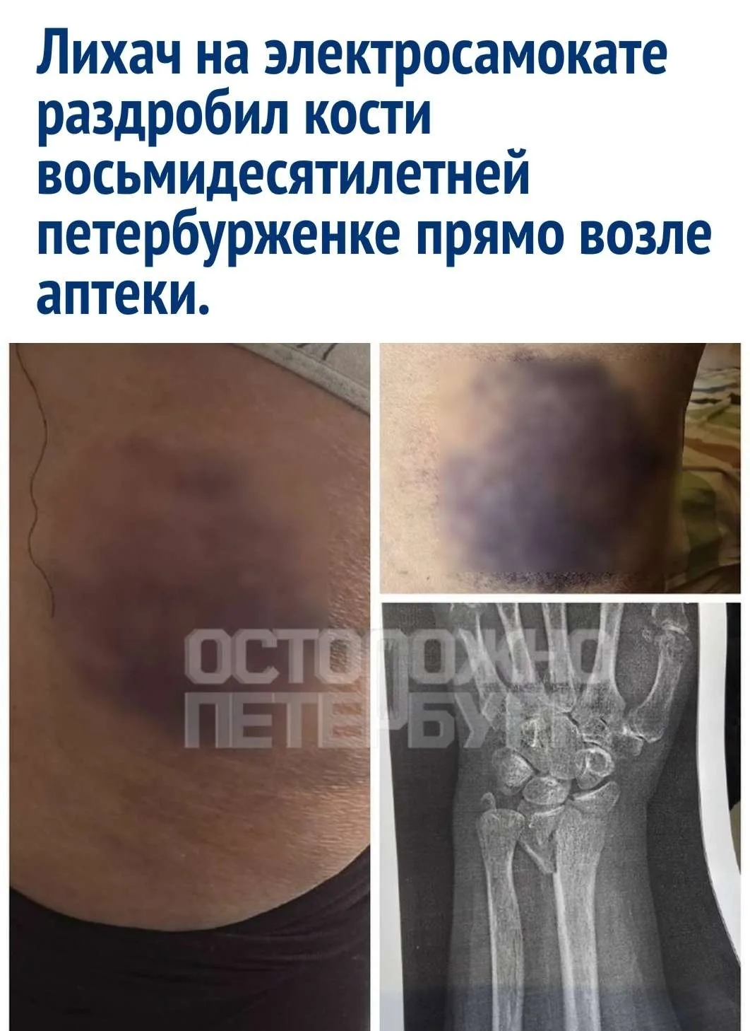 Обыденный поход за лекарствами по Народной улице обернулся ужасной ситуацией, когда мча...