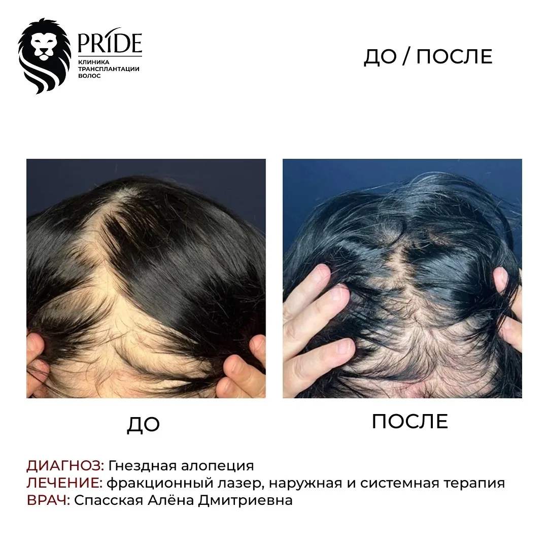 📩 Записаться на консультацию можно по ссылке в шапке профиля, личные сообщения или по ...
