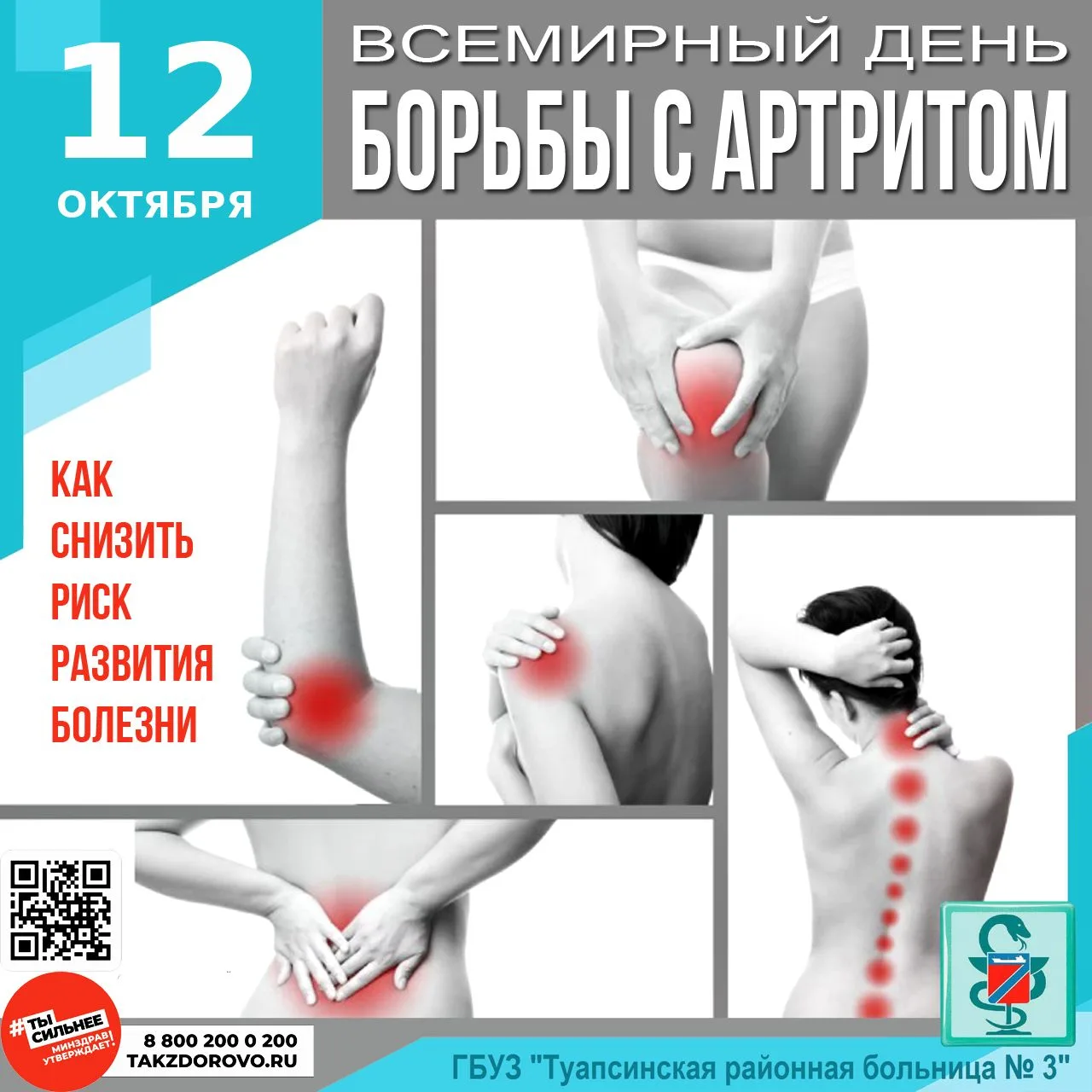 ЧТО НУЖНО ДЛЯ ПРОФИЛАКТИКИ АРТРИТА