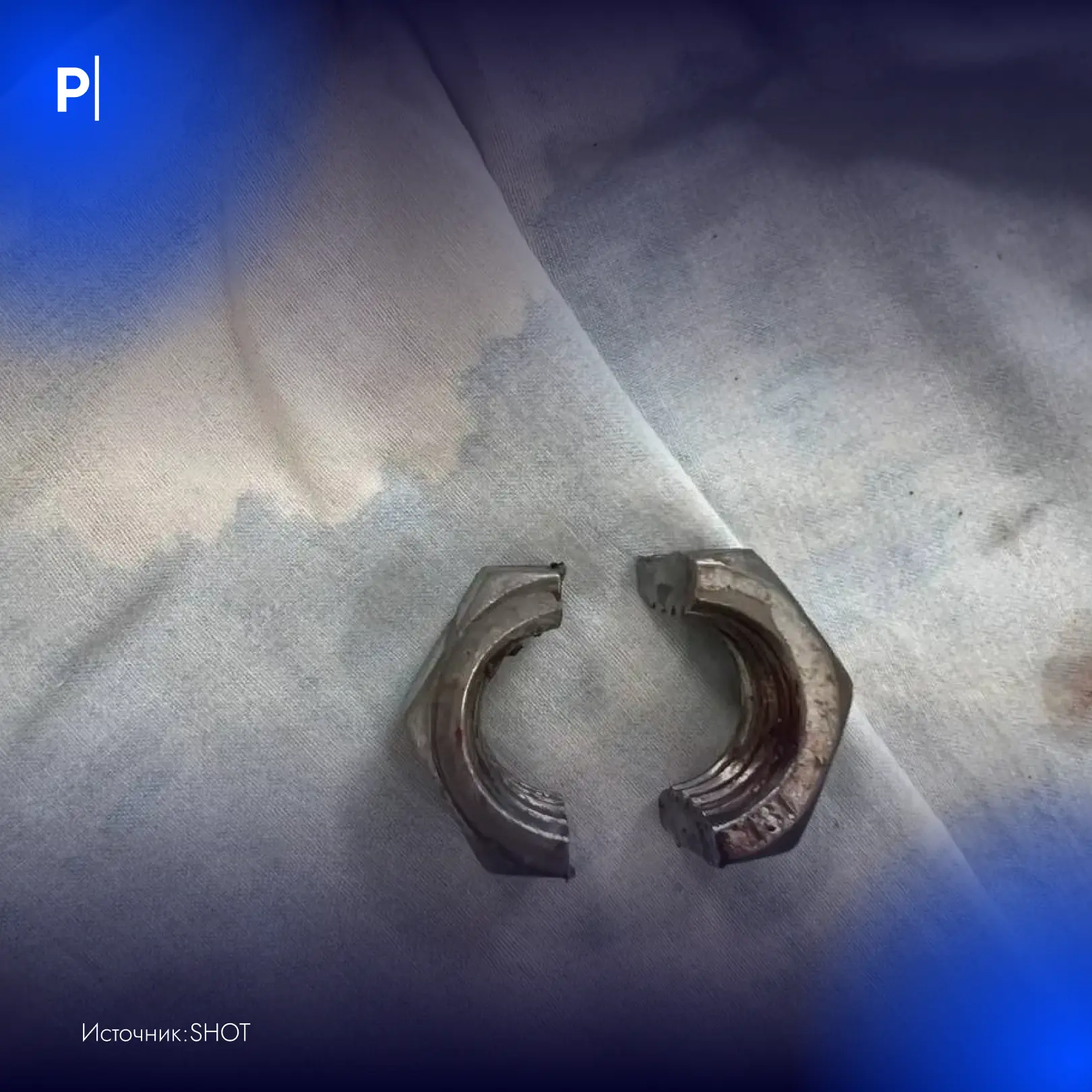 🔩Россиянин едва не лишился пениса после пьяного дня рождения.