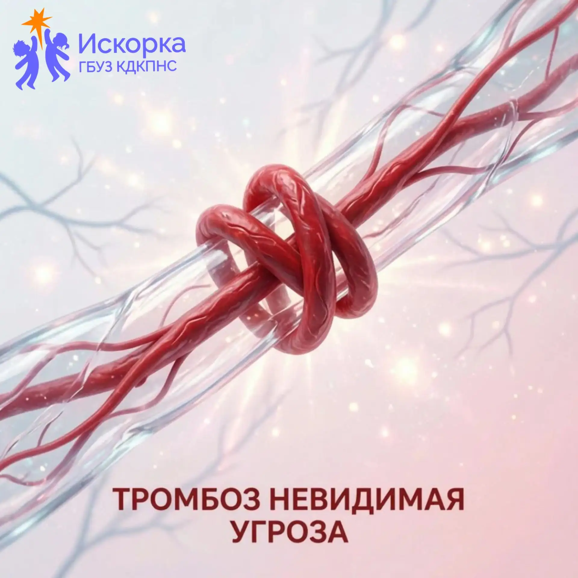 Тромбоз: невидимая угроза