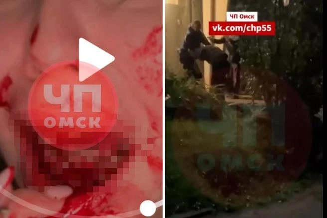 ❗️Выбиты зубы и рассечена губа: омич избил девушку из-за телефонного звонка.