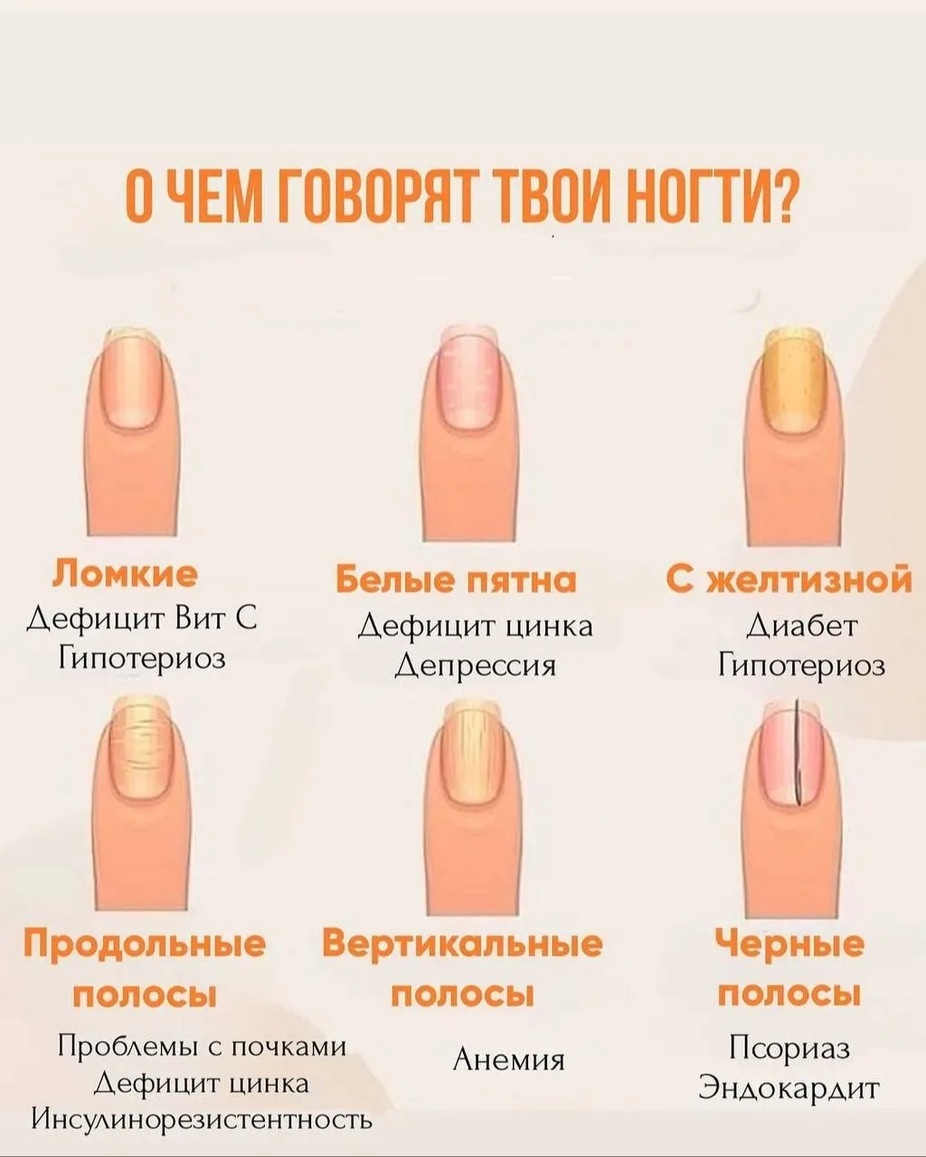О чем говорят ваши ногти?