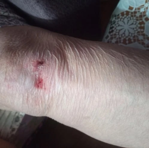 😳Пенсионерка упала и поранила ноги из-за опасного бордюра на остановке «Механический з...