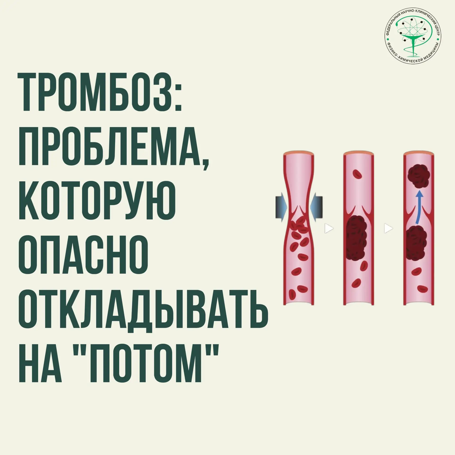 💥 Тромбоз: проблема, которую опасно откладывать «на потом»