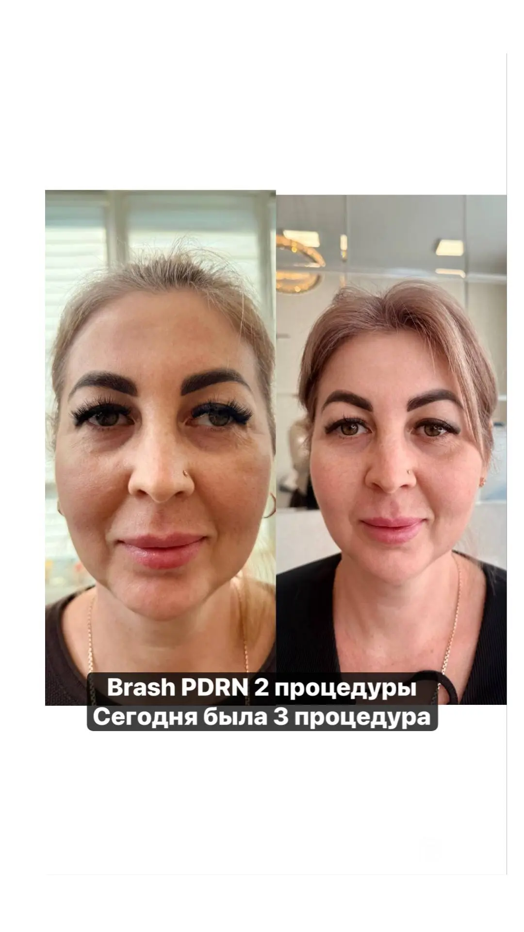 Что будет если 2 раза в месяц приходить к нам на BRASH?