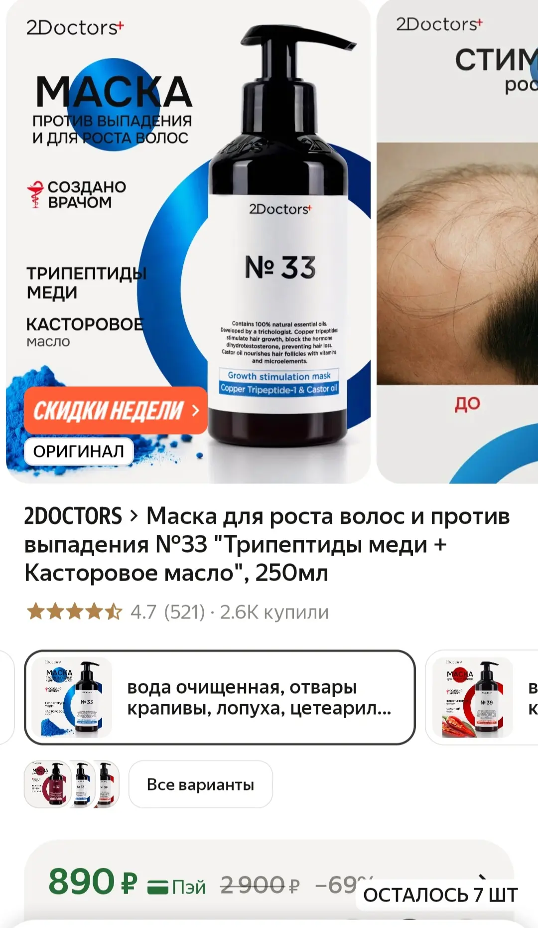 ‼️Заметить новые волосы уже через месяц? Реально!