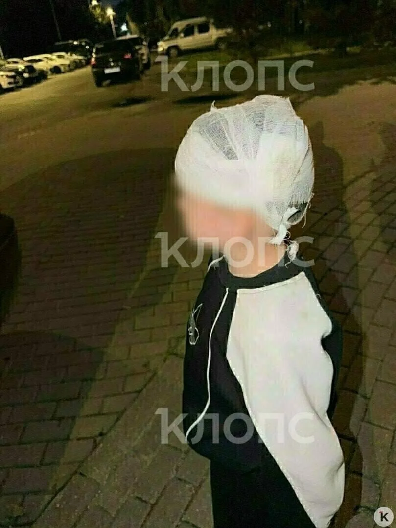 В Калининграде школьники бросили камень в 4-летнего мальчика — ребёнок получил сотрясен...