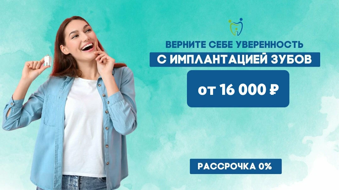 Установка зубного импланта в Вологде – Всего за 16 000 ₽