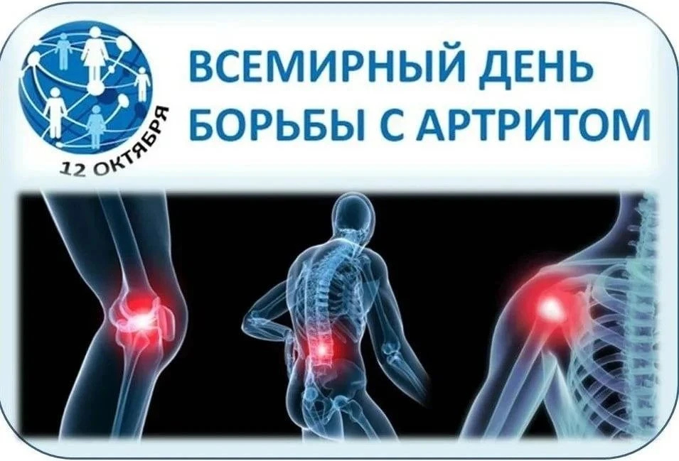✅ 12 октября - Всемирный день борьбы с артритом
