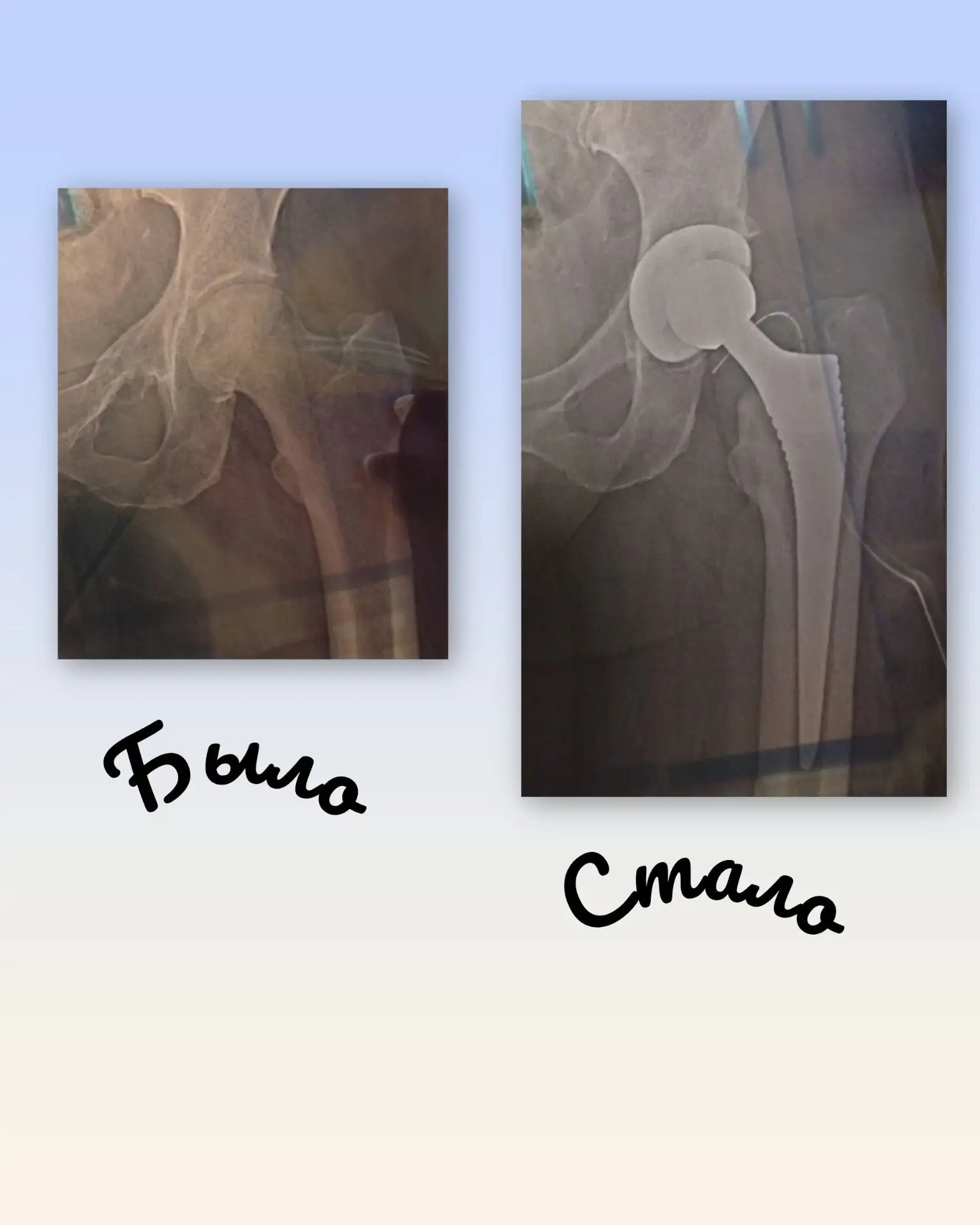 Вот ,такую операцию мне сделали сейчас)