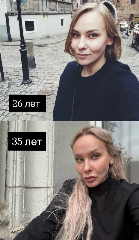 Лера сказала, что восхищается положением моих щек — они с возрастом сползают вниз, но м...