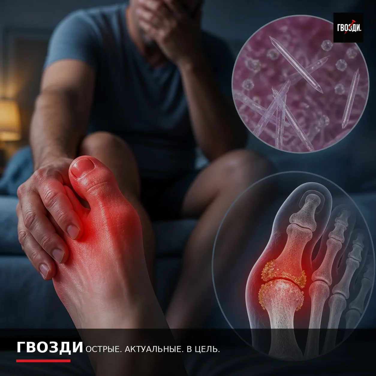 Подагра: почему внезапно болит сустав и когда нужна срочная помощь