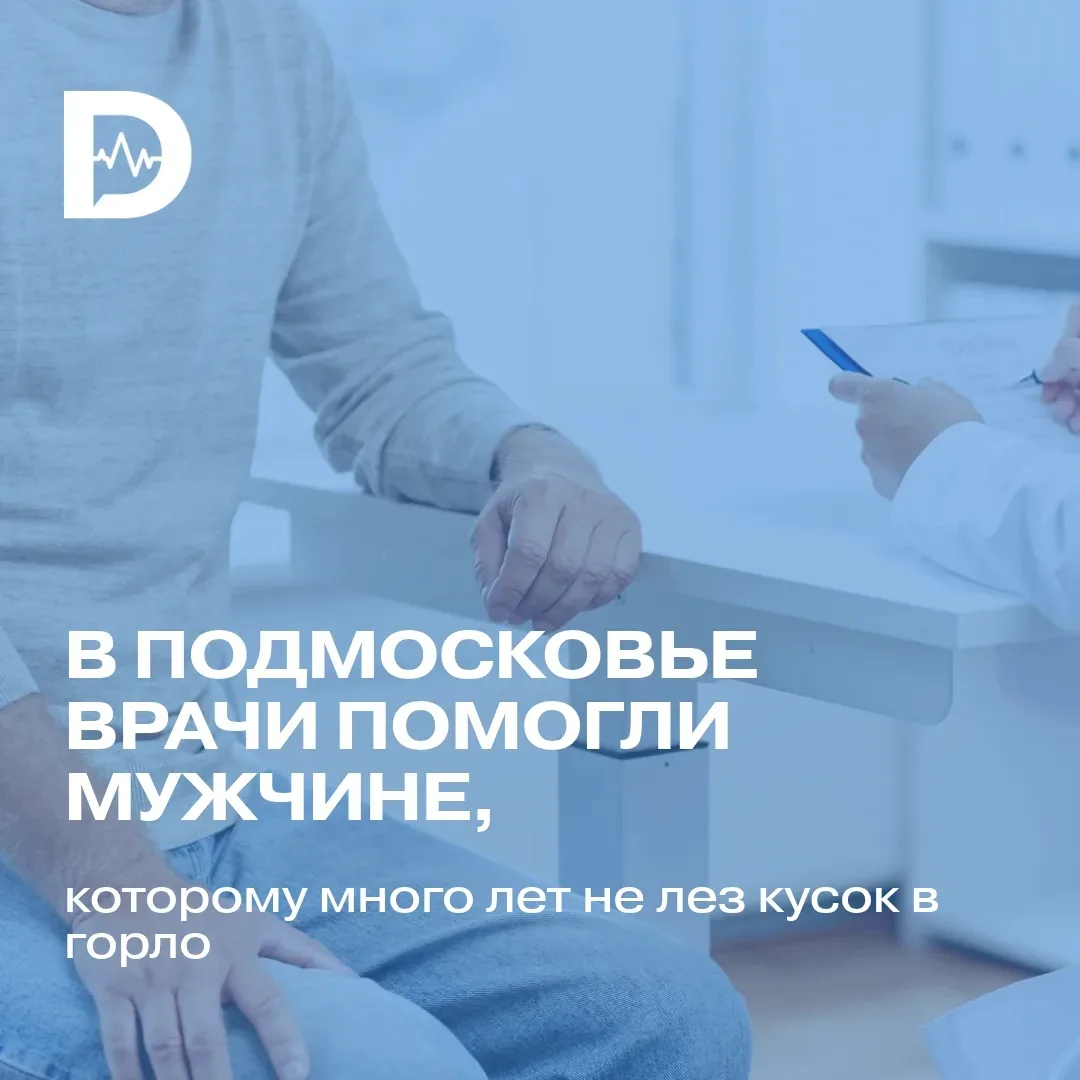 🔍 Успех в борьбе с дивертикулом Ценкера!