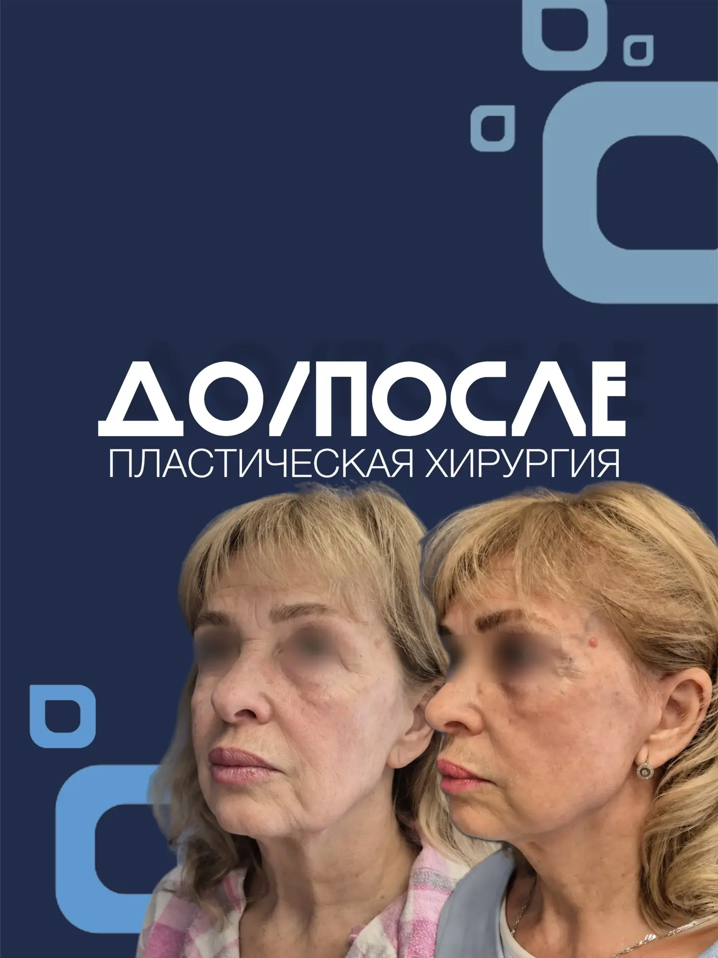 Годы меняют лицо по-разному. Но иногда хочется вернуть не только молодость, но и узнава...