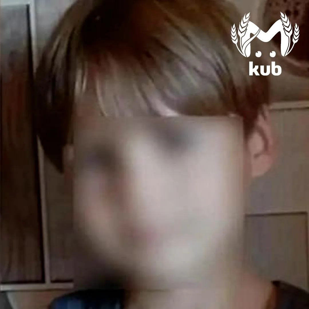 Собаки сняли мальчику скальп, откусили правое и половину левого уха на платной рыбалке ...