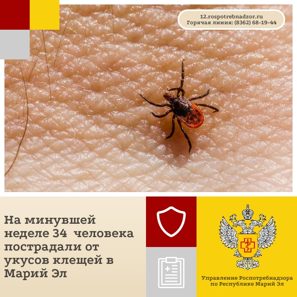 За прошедшую неделю с 28 сентября  по 4 октября  за медицинской помощью обратились 34 п...