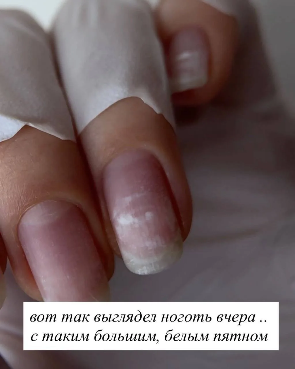 Быстрый способ восстановить ногтевую пластину: сегодня делимся отзывом #Ta2girls на кла...