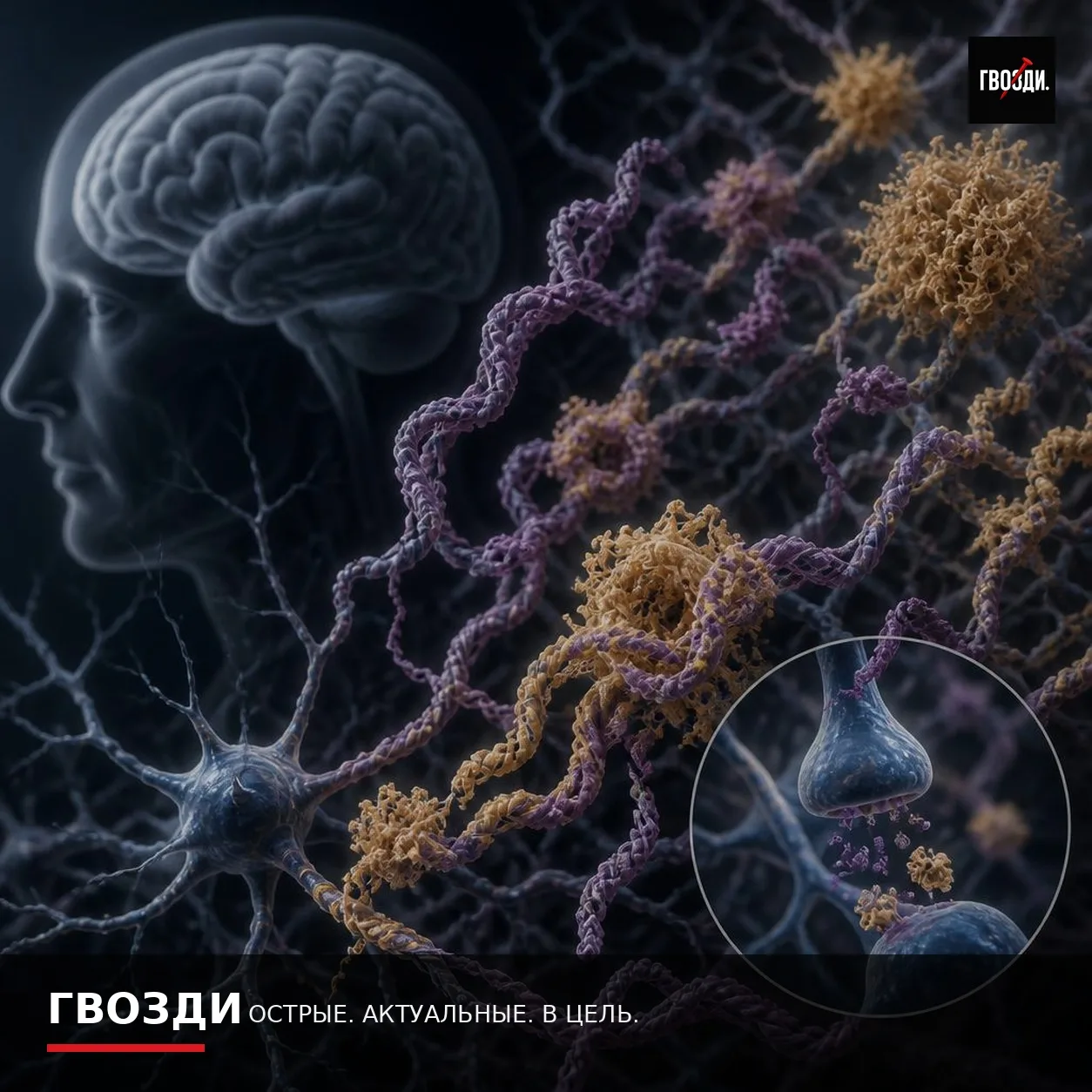 В исследованиях Альцгеймера предложили внимательнее изучить «второй» амилоид