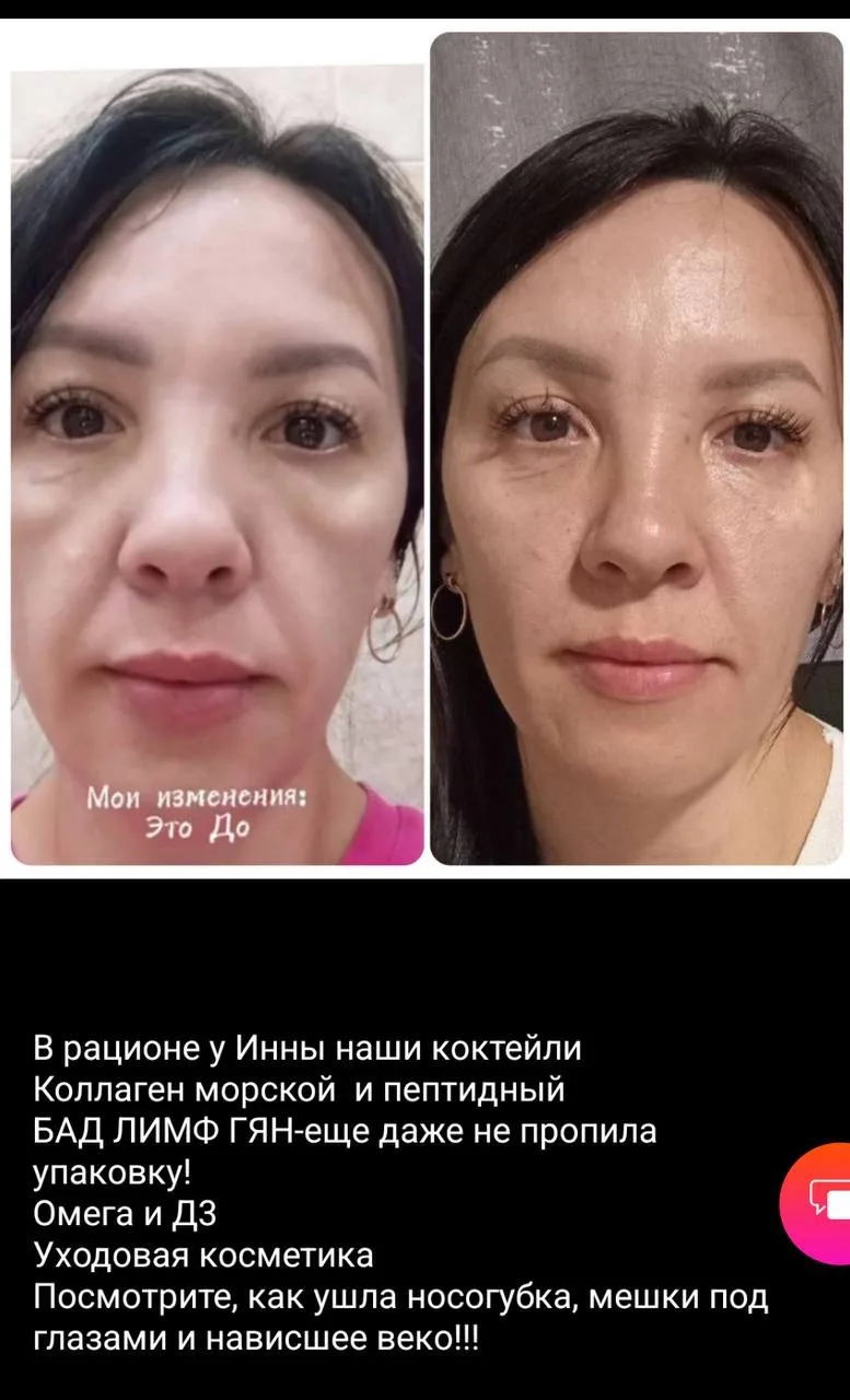 🔝🙏 Обязательно обратите внимание на отзывы — реальные впечатления тех, кто уже попроб...
