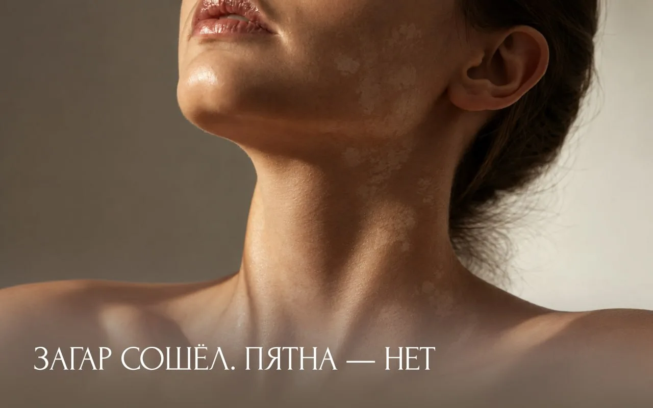 Загар сошёл. Пятна — нет
