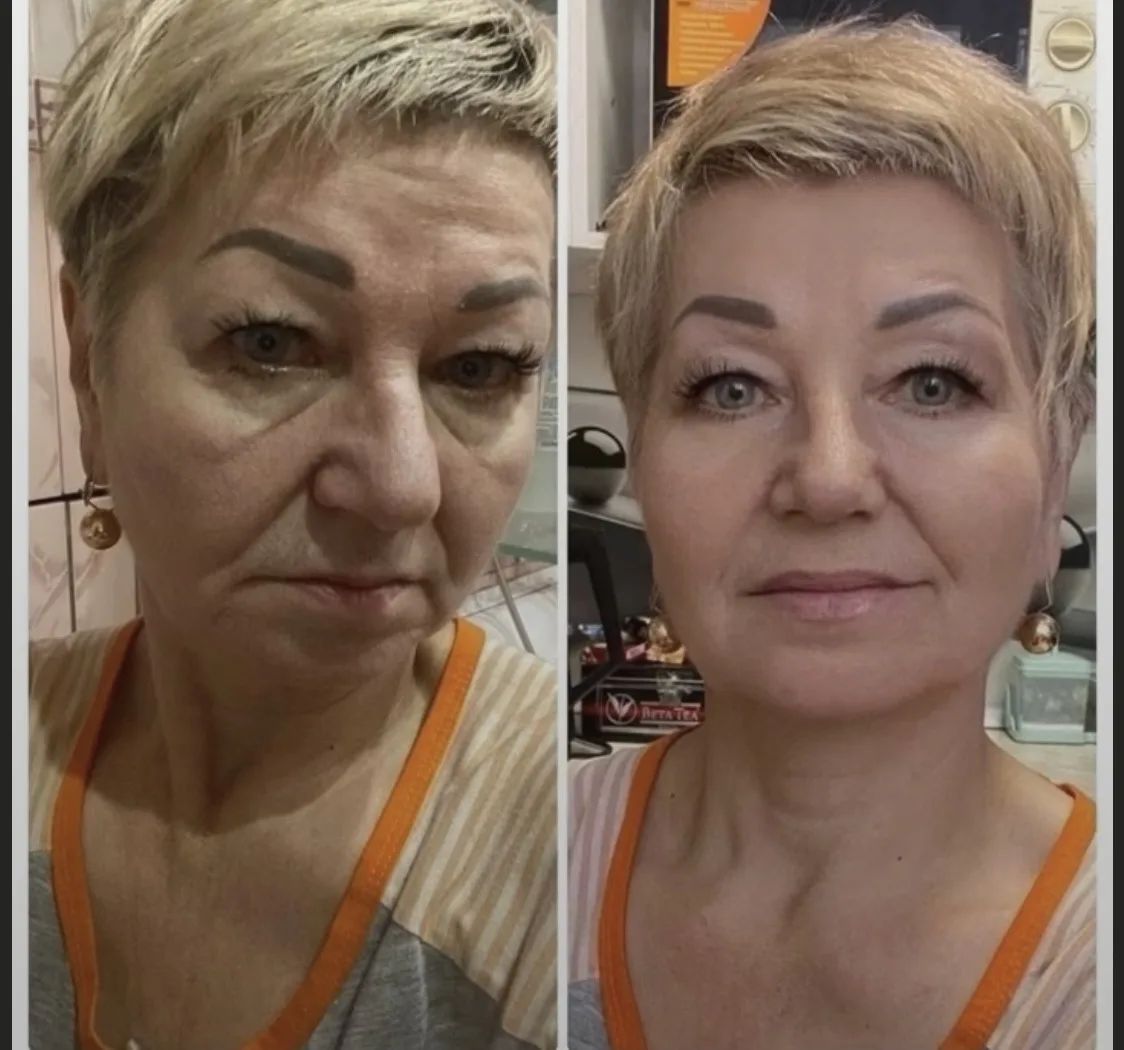 На коллагене🔥
