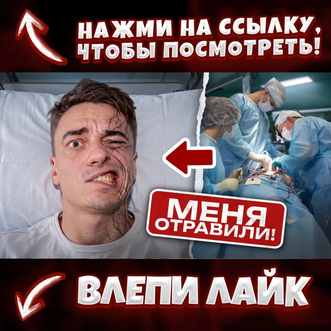 МЕНЯ ОТРАВИЛИ ИЗ-ЗА МОИХ ВИДЕО. Это ЛИЦЕВОЙ ПАРАЛИЧ. Я смогу ВЕРНУТЬ ЛИЦО?