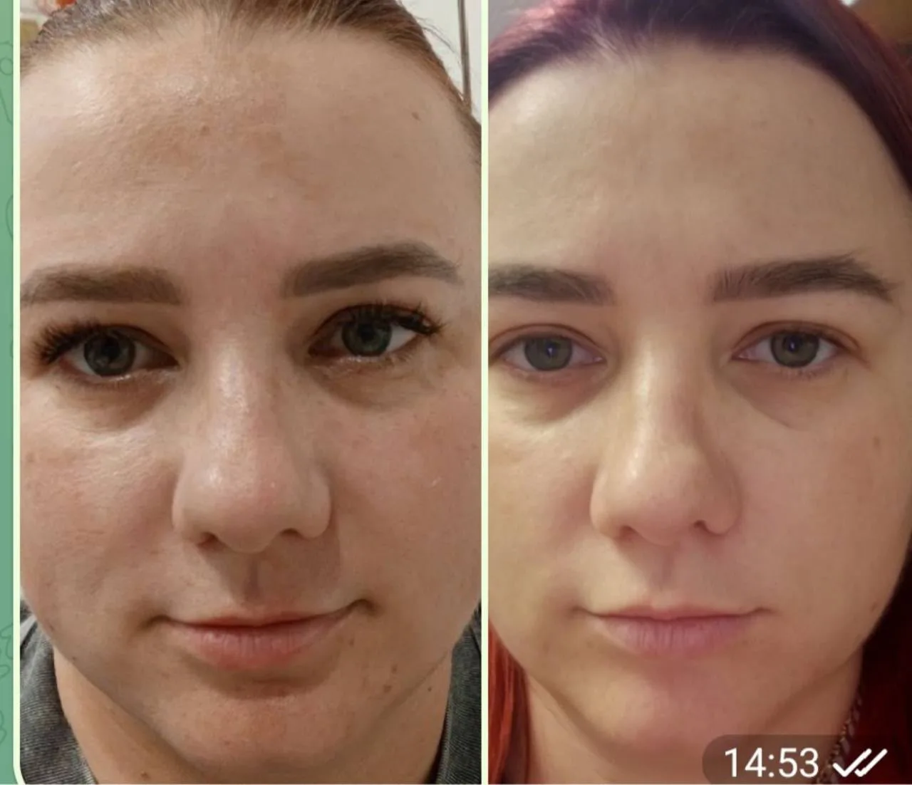 🔥 РЕЗУЛЬТАТЫ ПРИЁМА COLLAGEN PEPTIDES — СМОТРИМ В ОТЗЫВАХ! 🔝