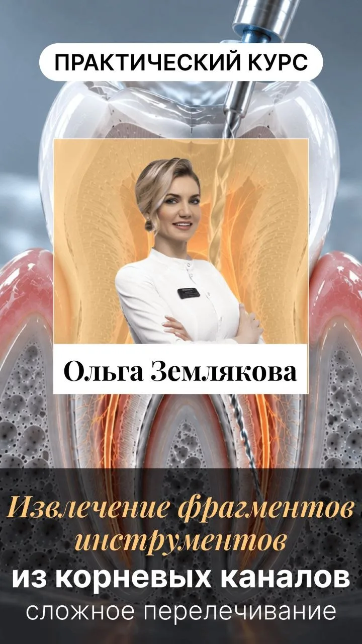 Извлечение фрагментов инструментов из корневых каналов ⭐️