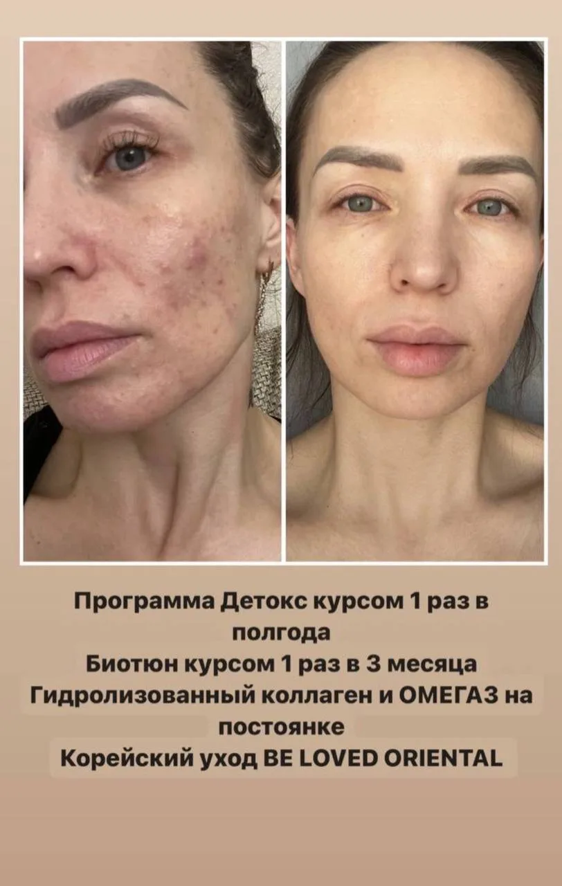 ❤️‍🔥 ПОДРОБНЕЕ — В ОТЗЫВАХ! 🔺