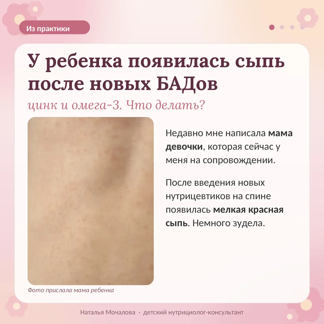 «Наталья, у дочки появилась сыпь после БАДов. Что делать?»Такая ситуация может заставит...