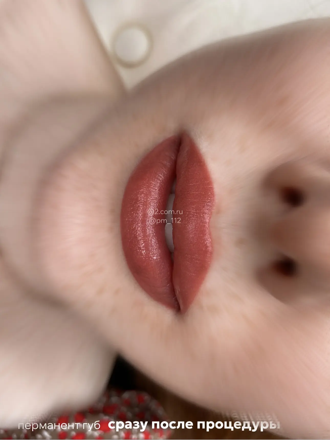 Лялячки, правда?💋 Сразу после процедуры.