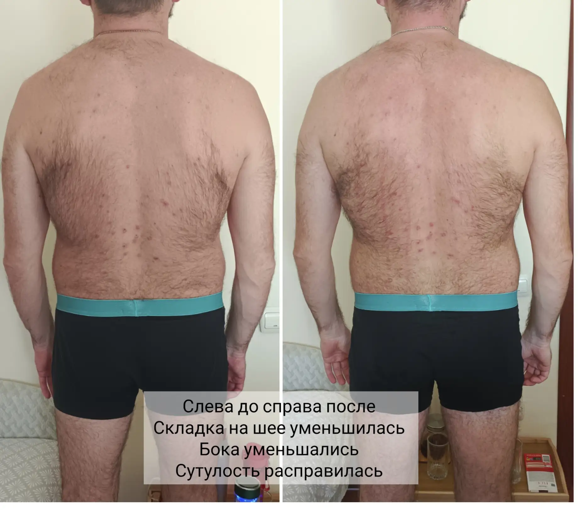 Один сеанс биоэнергорегуляции 🔥