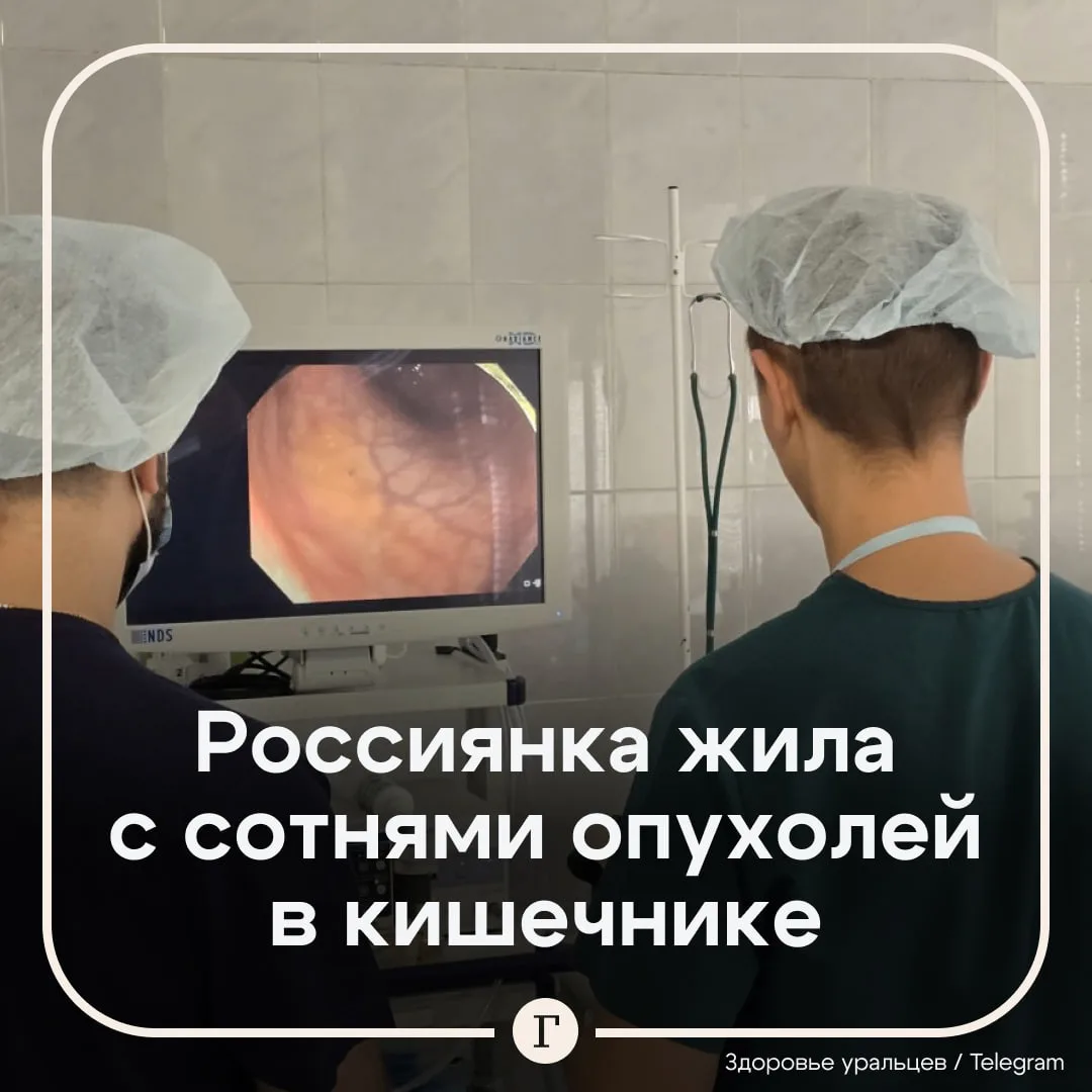 😱 Врачи спасли женщину с 210 опухолями в кишечнике и сохранили орган.