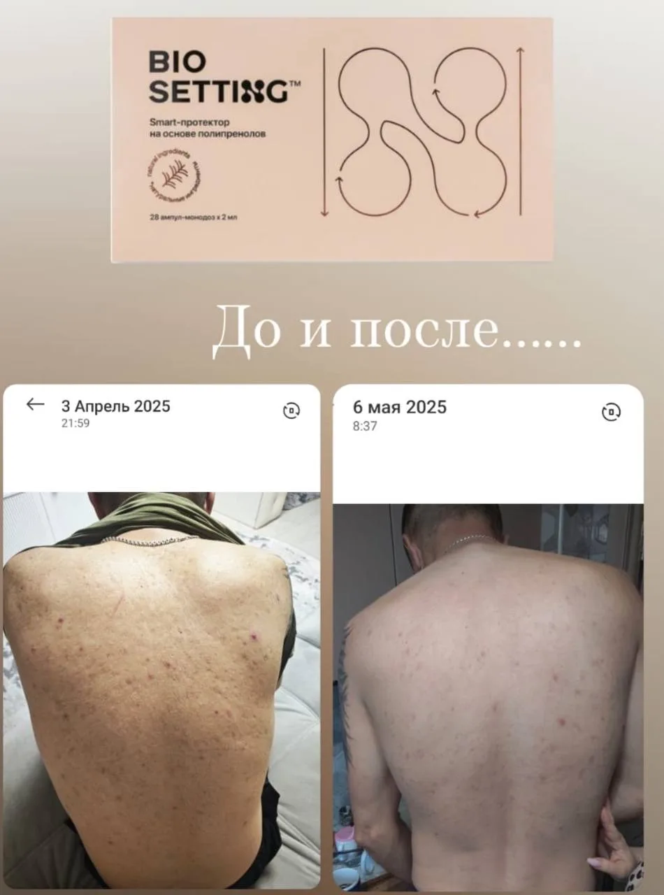 Однозначно рекомендую курильщикам 👍У кого есть проблемы с дыханием однозначно биосетин...