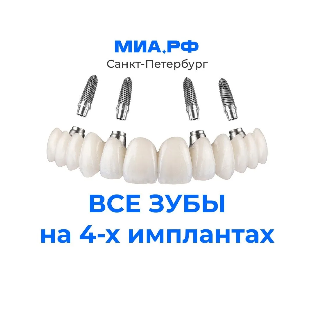 Новые зубы у экспертов методов «Всё-на-4» и «Всё-на-6»