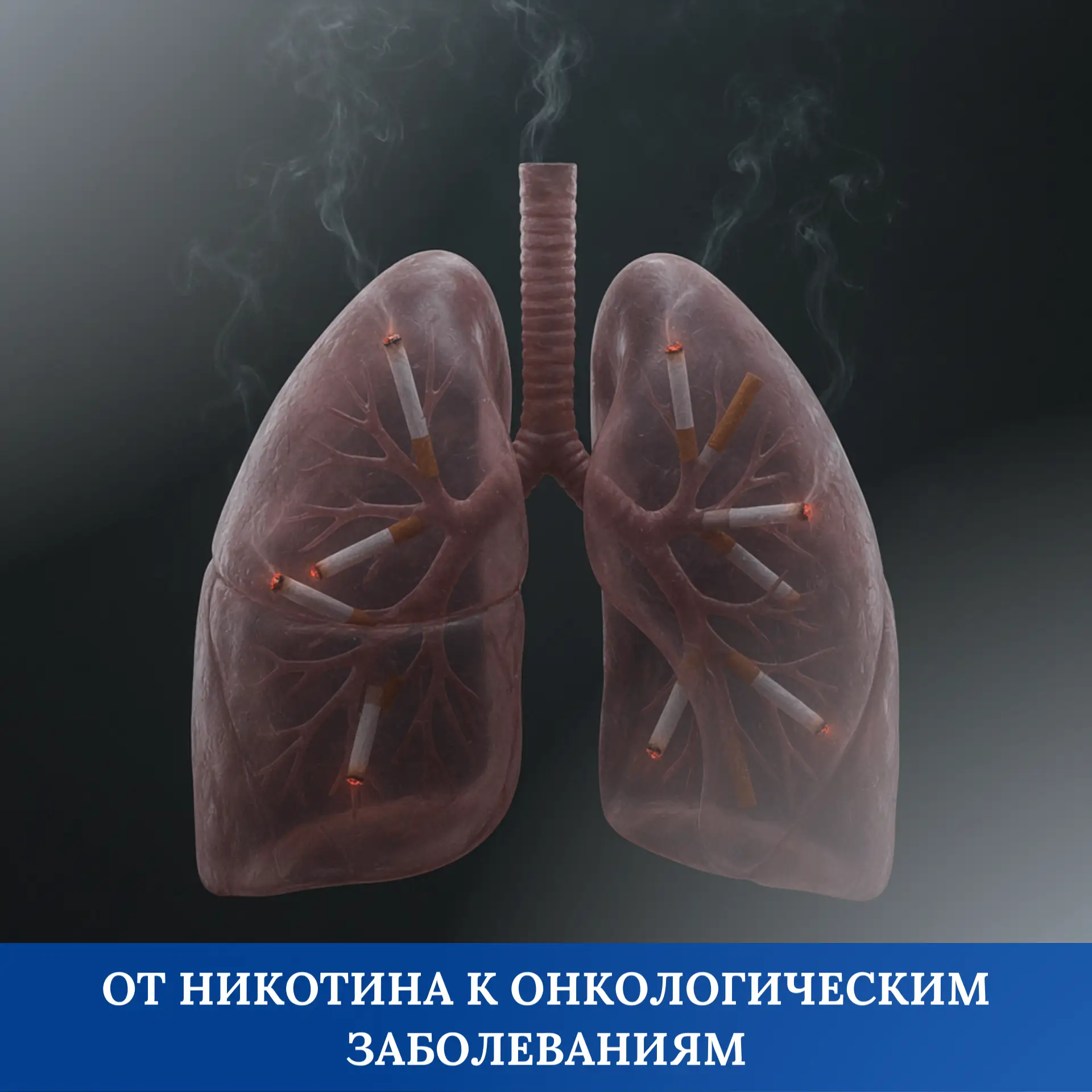 Рак легкого - главный вид рака, который провоцирует курение. Это одно из самых агрессив...