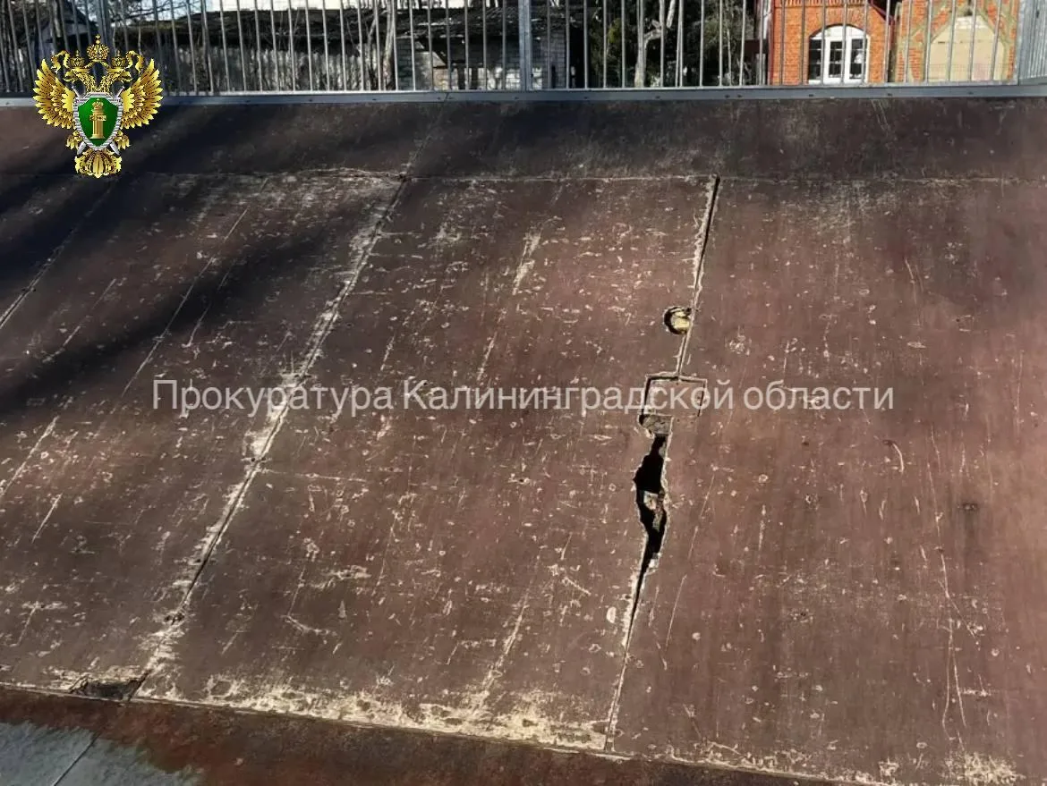 В Краснознаменске 9-летняя девочка получила травмы на скейт-площадке: колесо самоката п...