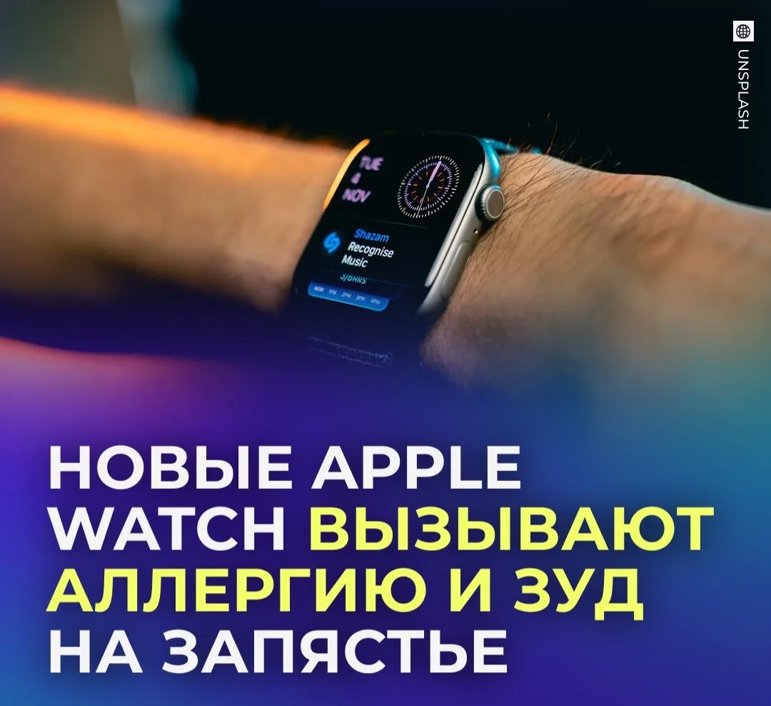 ⌚ Владельцы новых Apple Watch пожаловались на зуд из-за часов.