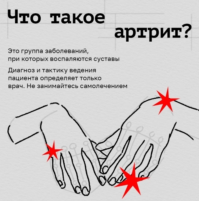 🗓 Сегодня Всемирный день борьбы с артритом?