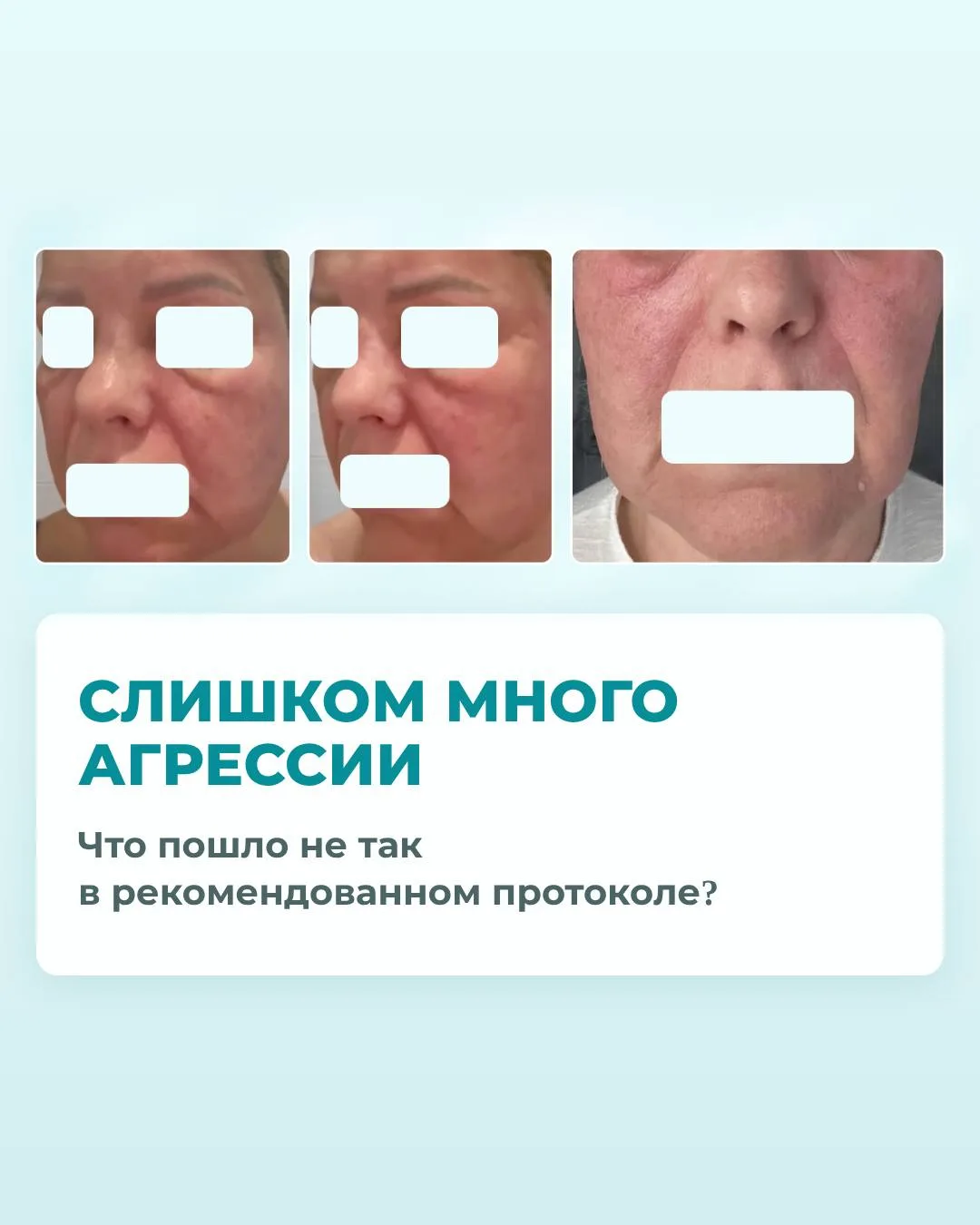 🤔 Вернёмся ко вчерашнему кейсу: почему же «рекомендованный» протокол дал такую реакцию?