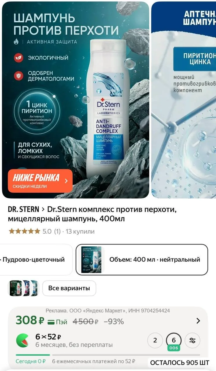 Если кожа головы быстро жирнится, а перхоть появляется снова и снова, присмотритесь к э...