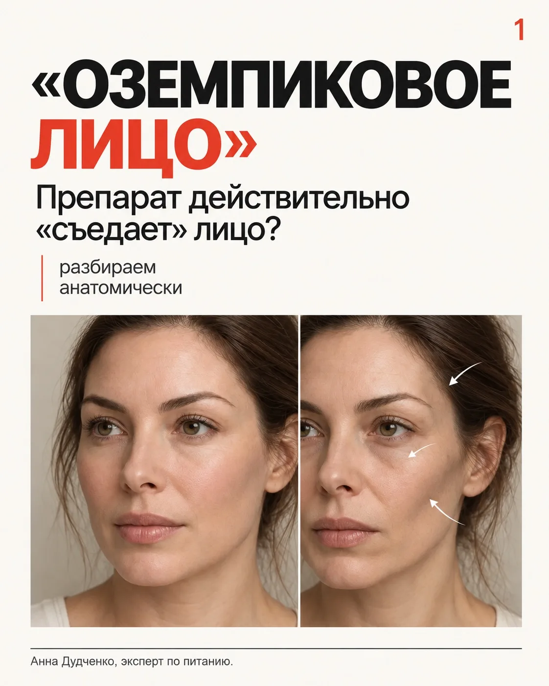 Похудела, а лицо будто постарело?