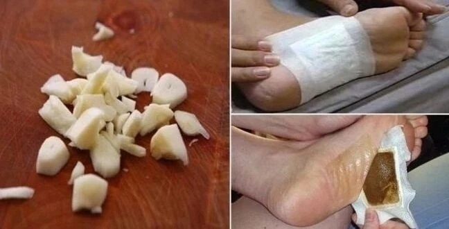 🌿 Очищение организма с помощью чеснока и лука!