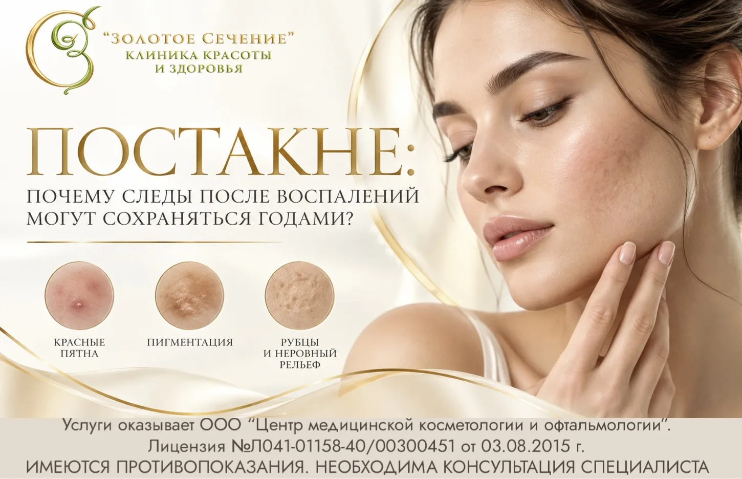 Постакне: почему следы после воспалений могут сохраняться годами?