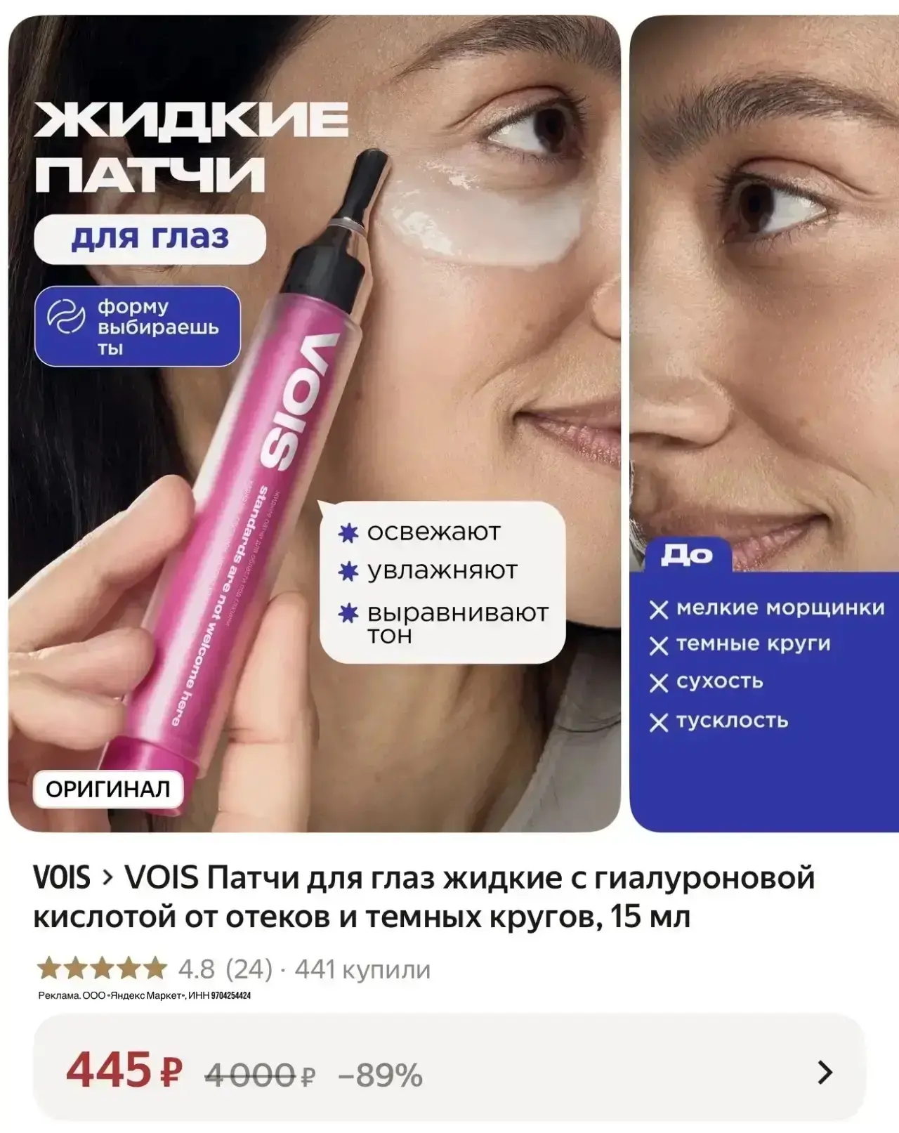 НОВИНОЧКА Жидкие патчи 🤩