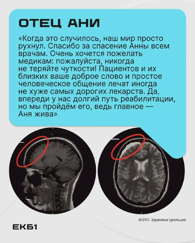 Врачи рассказали, как спасали 17-летнюю Аню, которую сбил Mercedes на переходе.