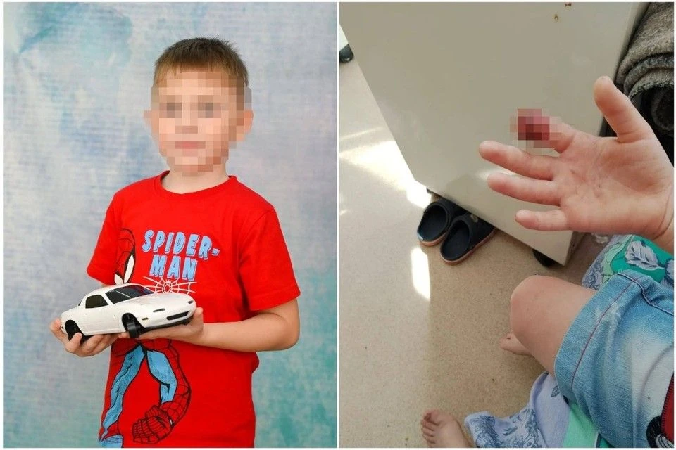 «Мама, как мне теперь с этим жить?»: 6-летний мальчик лишился пальца во время игры в пр...