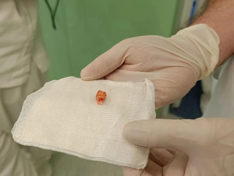 🧠 В Челябинской областной клинической больнице спасли от повторного инсульта жителя Тр...