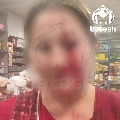 Под Уфой ревнивица ткнула «розочкой» в лицо бывшей девушке своего парня